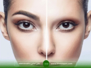 کاشت ابرو بهتر است یا میکروبلیدینگ کدام را انجام بدیم؟