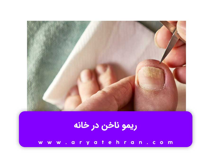 چگونه ناخن کاشت را بکنیم