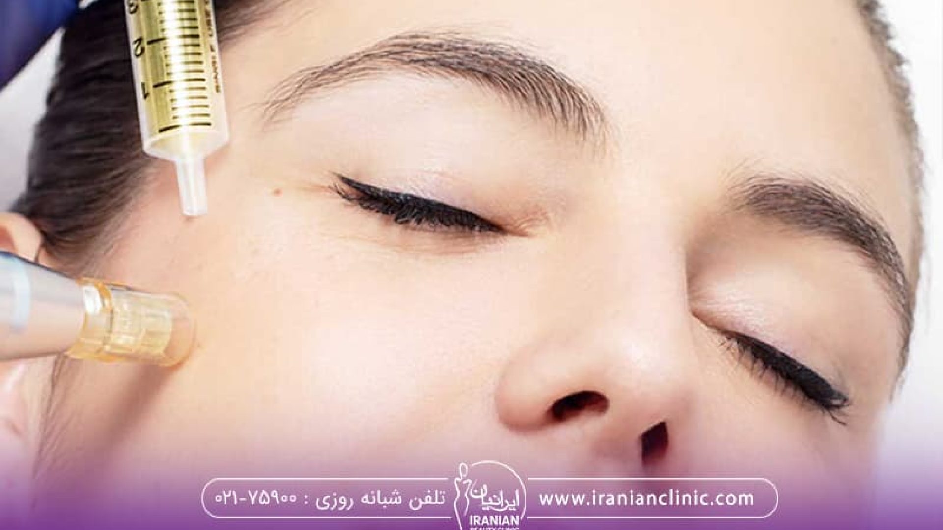 مزوتراپی صورت برای جوانسازی و تغذیه پوست استفاده می‌شود و شامل تزریق محلول‌های تقویتی و جوان‌کننده به لایه میانی پوست با استفاده از سوزن‌های ظریف است. این روش همچنین برای لاغری و سفت کردن پوست نواحی مختلف بدن کاربرد دارد.